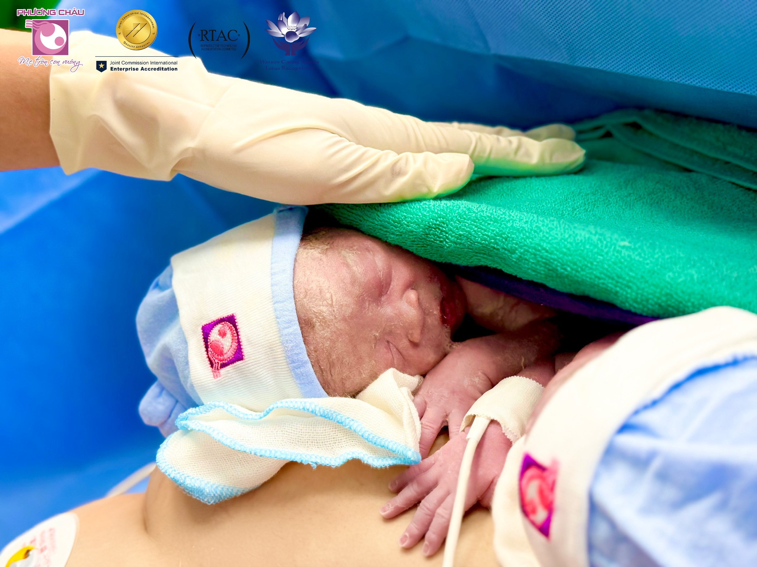 Huyết áp tăng cao đột ngột ở mẹ bầu mang song thai 33 tuần và hành trình xử trí kịp thời