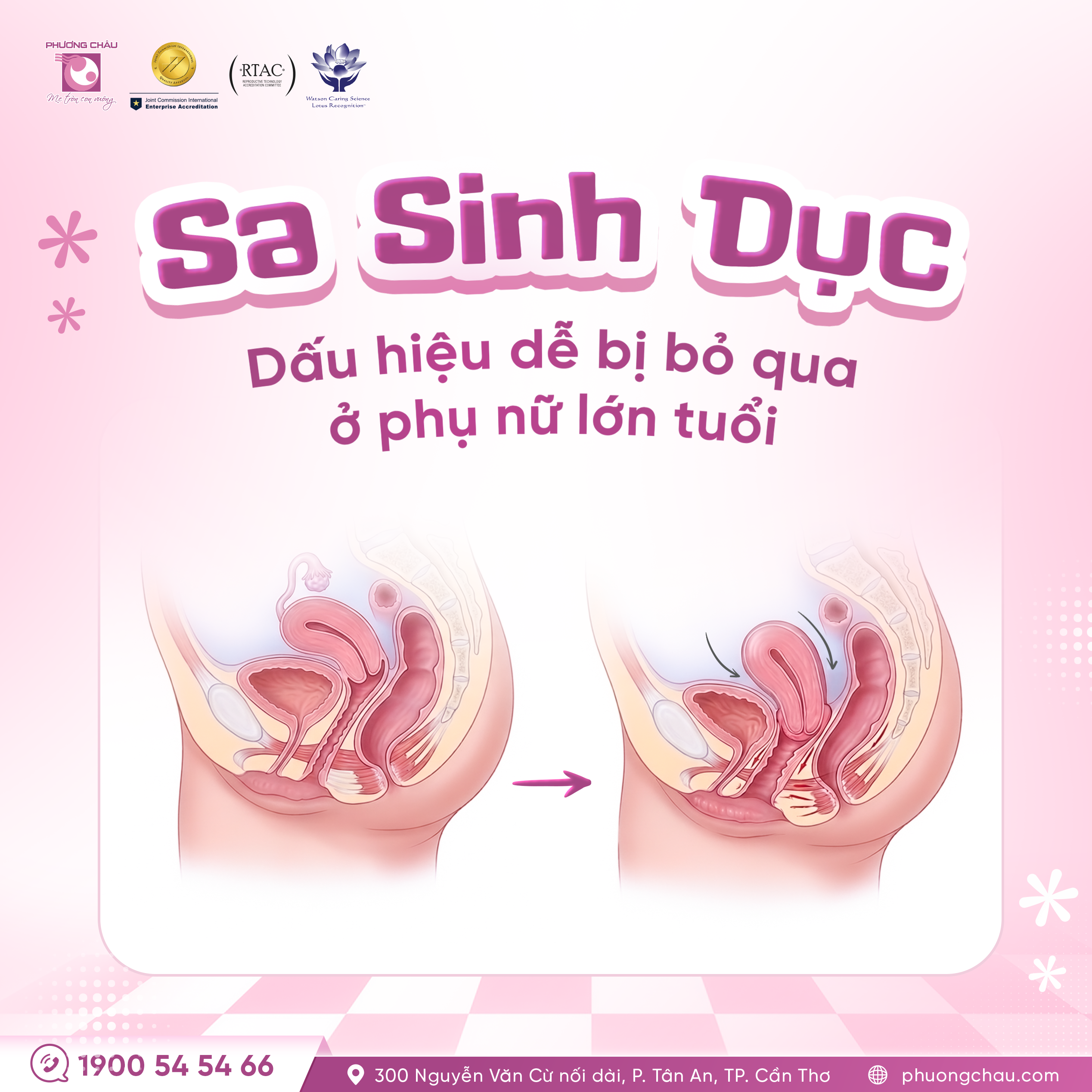 Sa sinh dục & Những điều cần lưu ý