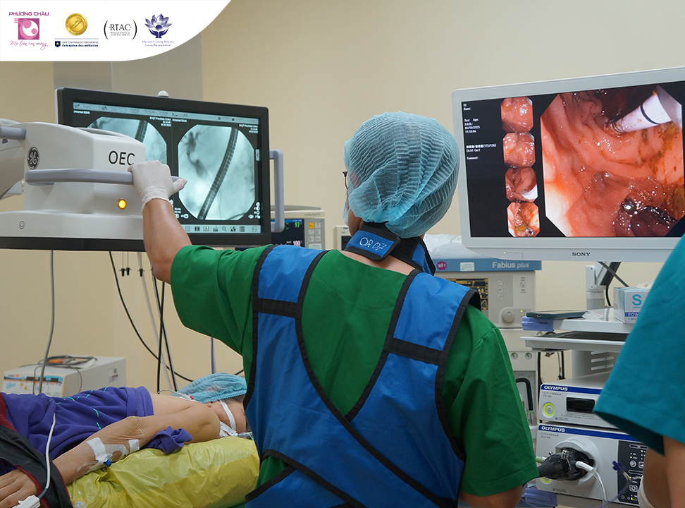 Nội soi mật tụy ngược dòng (ERCP): Cuộc cách mạng trong chẩn đoán và điều trị bệnh lý đường mật