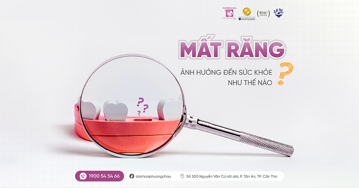 Mất răng lâu năm ảnh hưởng gì đến sức khỏe và vì sao không nên xem nhẹ?