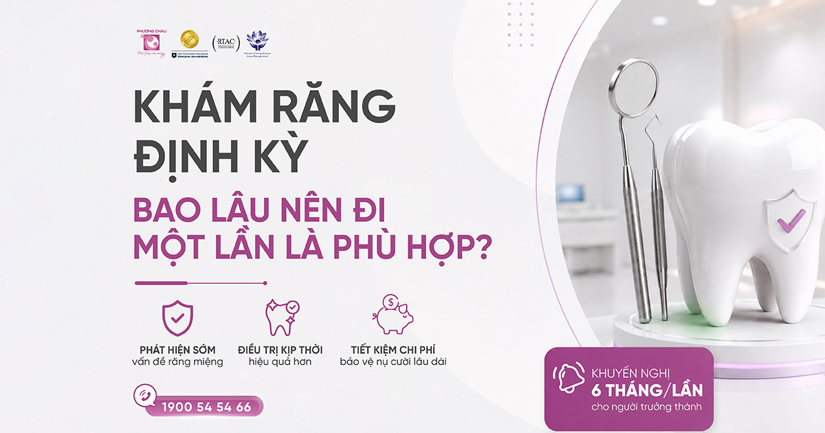 Khám răng định kỳ: Bao lâu nên đi 1 lần là phù hợp?