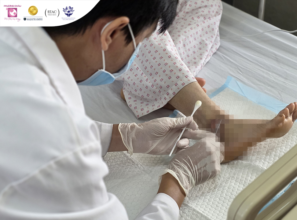 Từ một vết loét nhỏ ở mắt cá chân đến hành trình giữ lại sự an toàn cho bàn chân người bệnh đái tháo đường