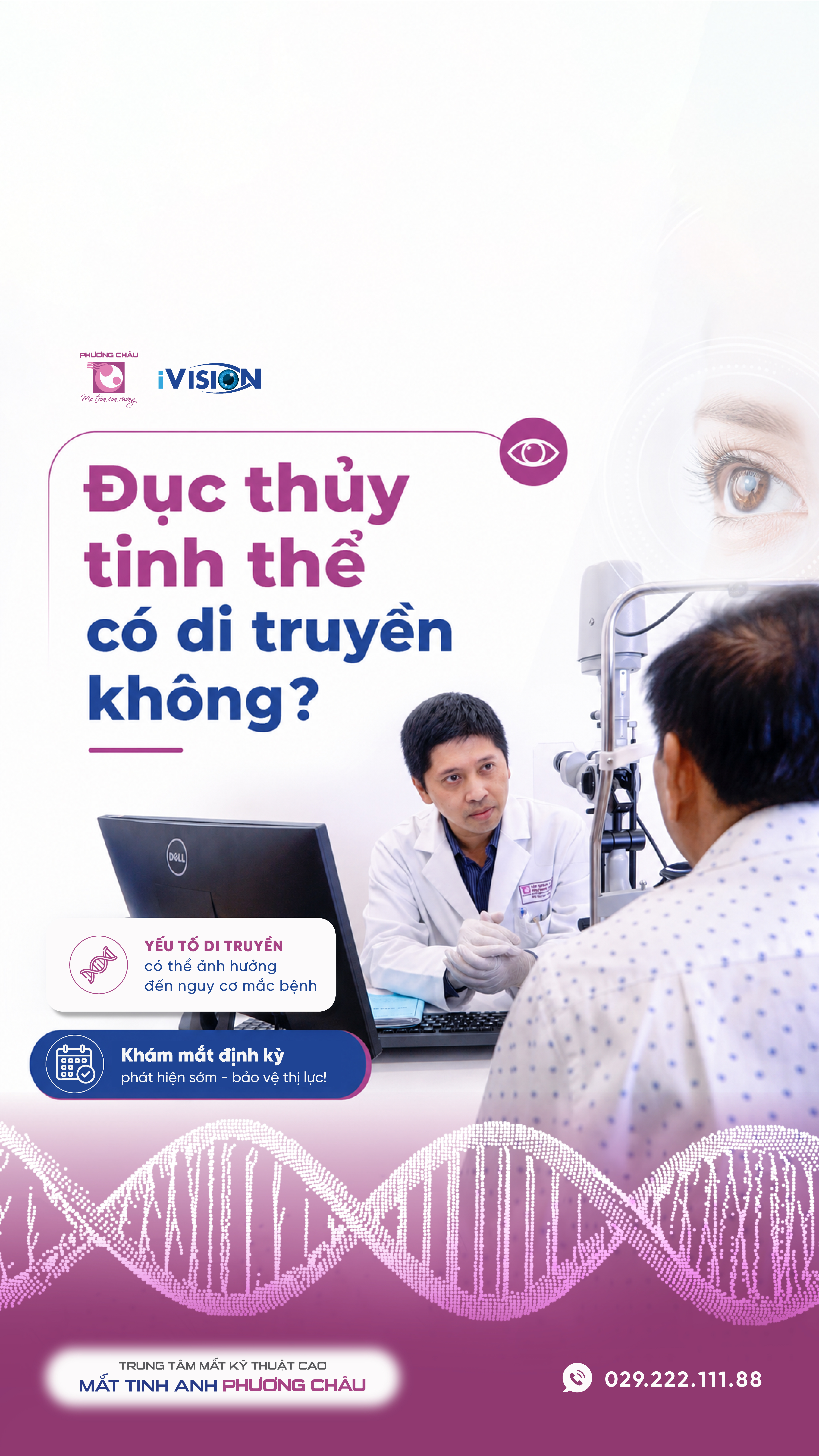 Tìm hiểu bệnh đục thủy tinh thể có di truyền không