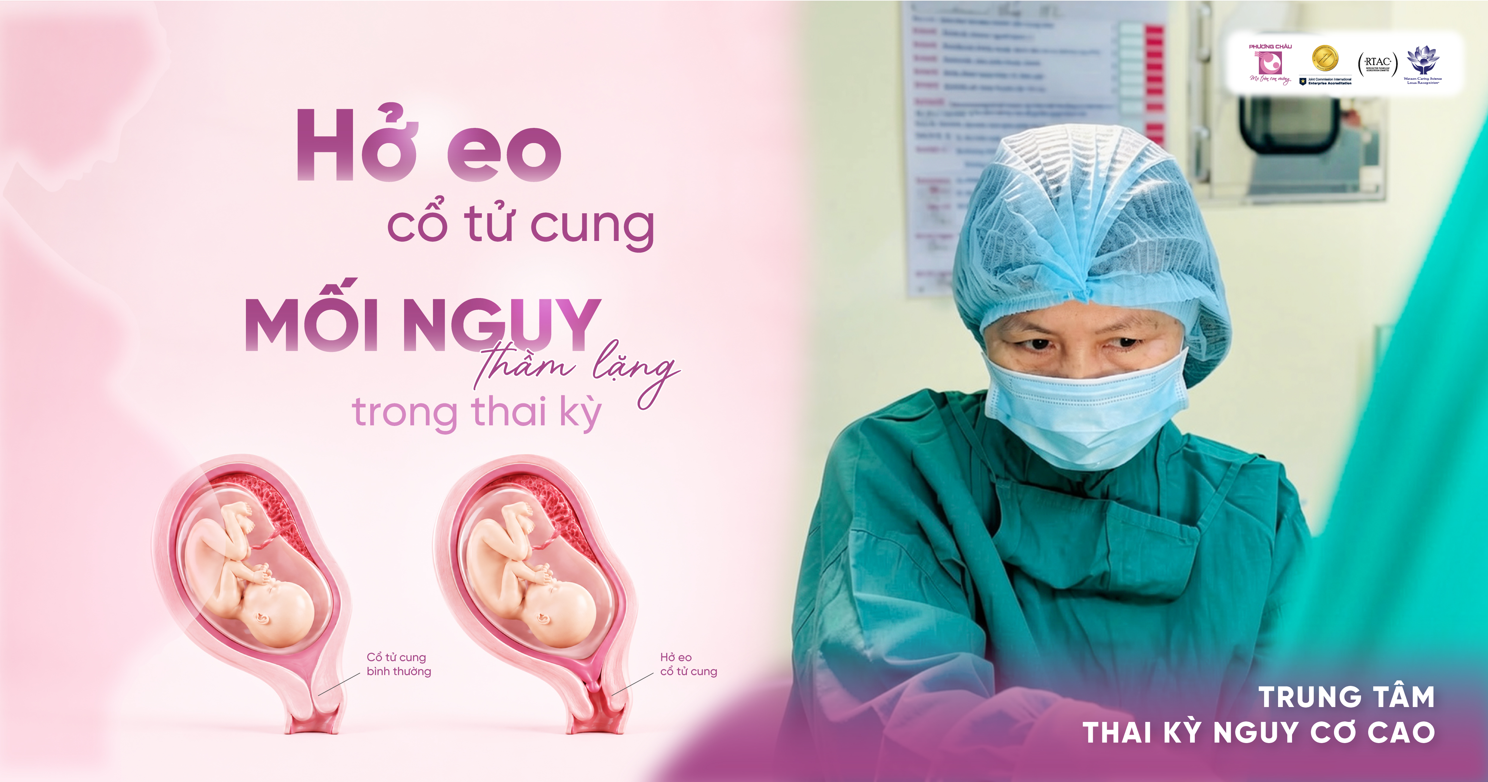 Nỗi đau mất con và "hung thủ" thầm lặng mang tên hở eo CTC