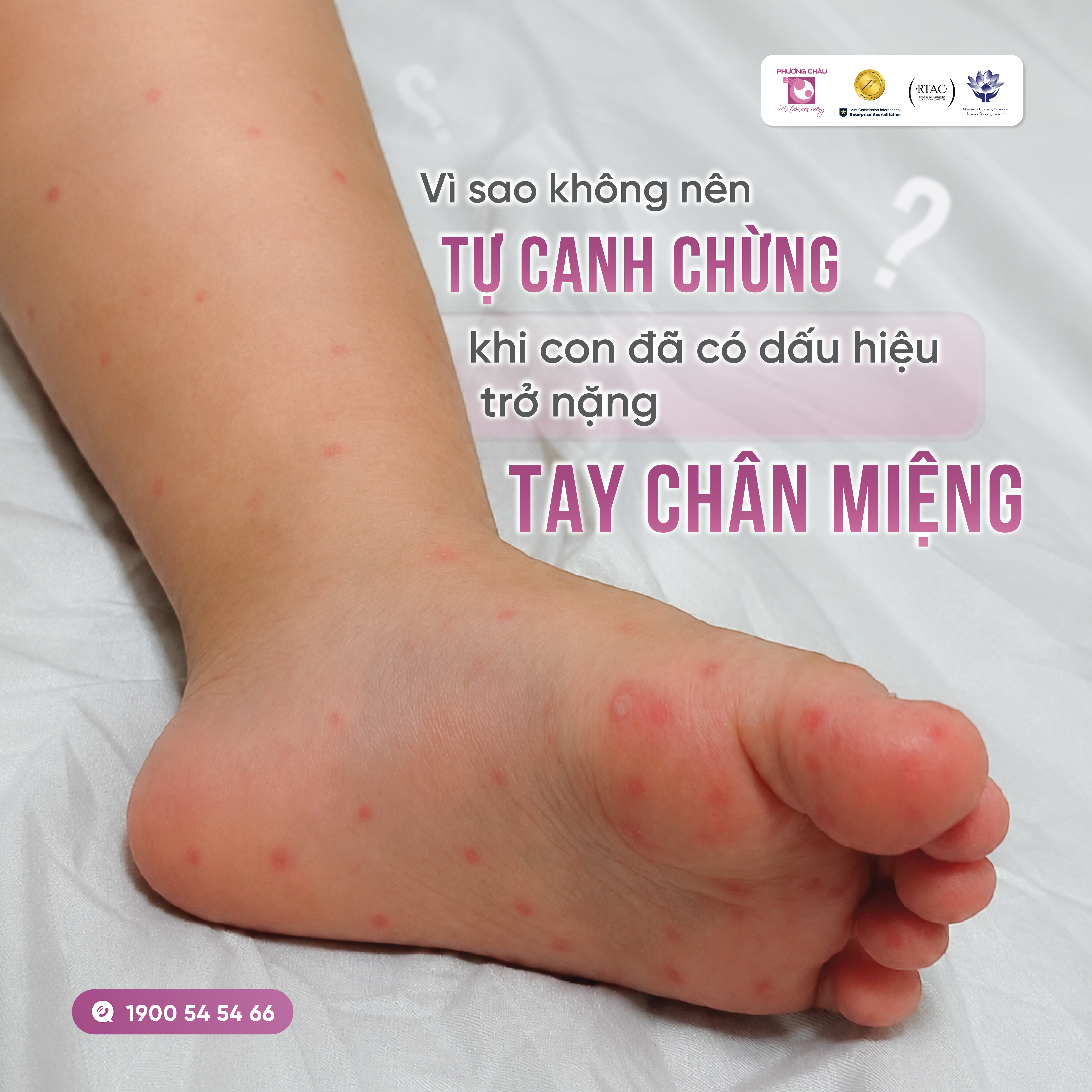 Vì sao không nên ở nhà khi con đã có dấu hiệu trở nặng tay chân miệng?