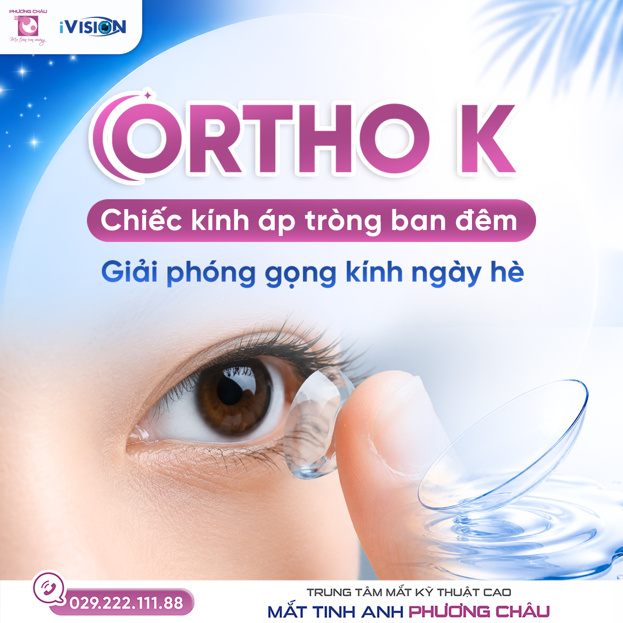 Kính Áp Tròng Ban Đêm Ortho-K Giúp Trẻ Tạm Biệt Kính Gọng Ngày Hè