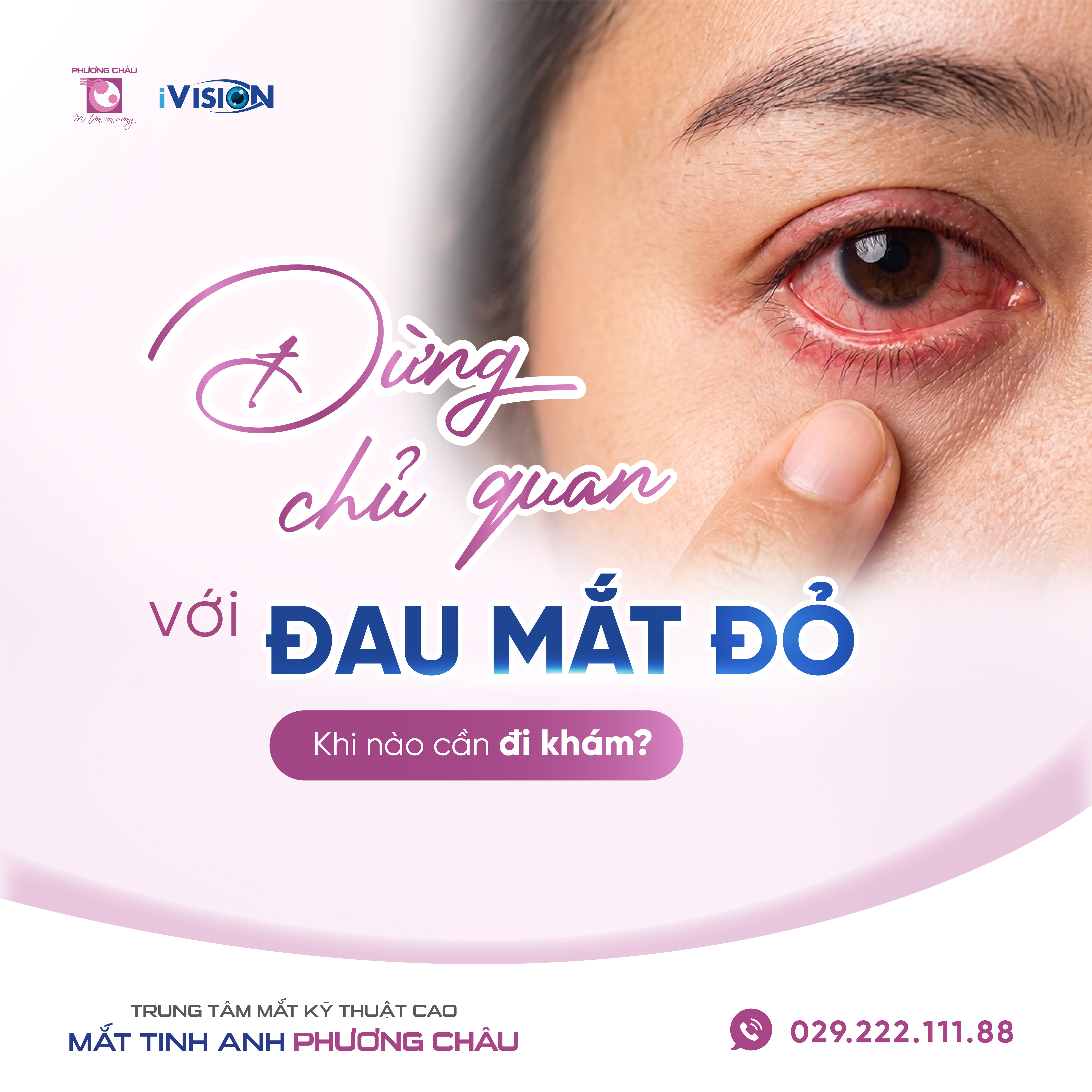 Đừng Chủ Quan Với Đau Mắt Đỏ: Khi Nào Cần Đi Khám Ngay?