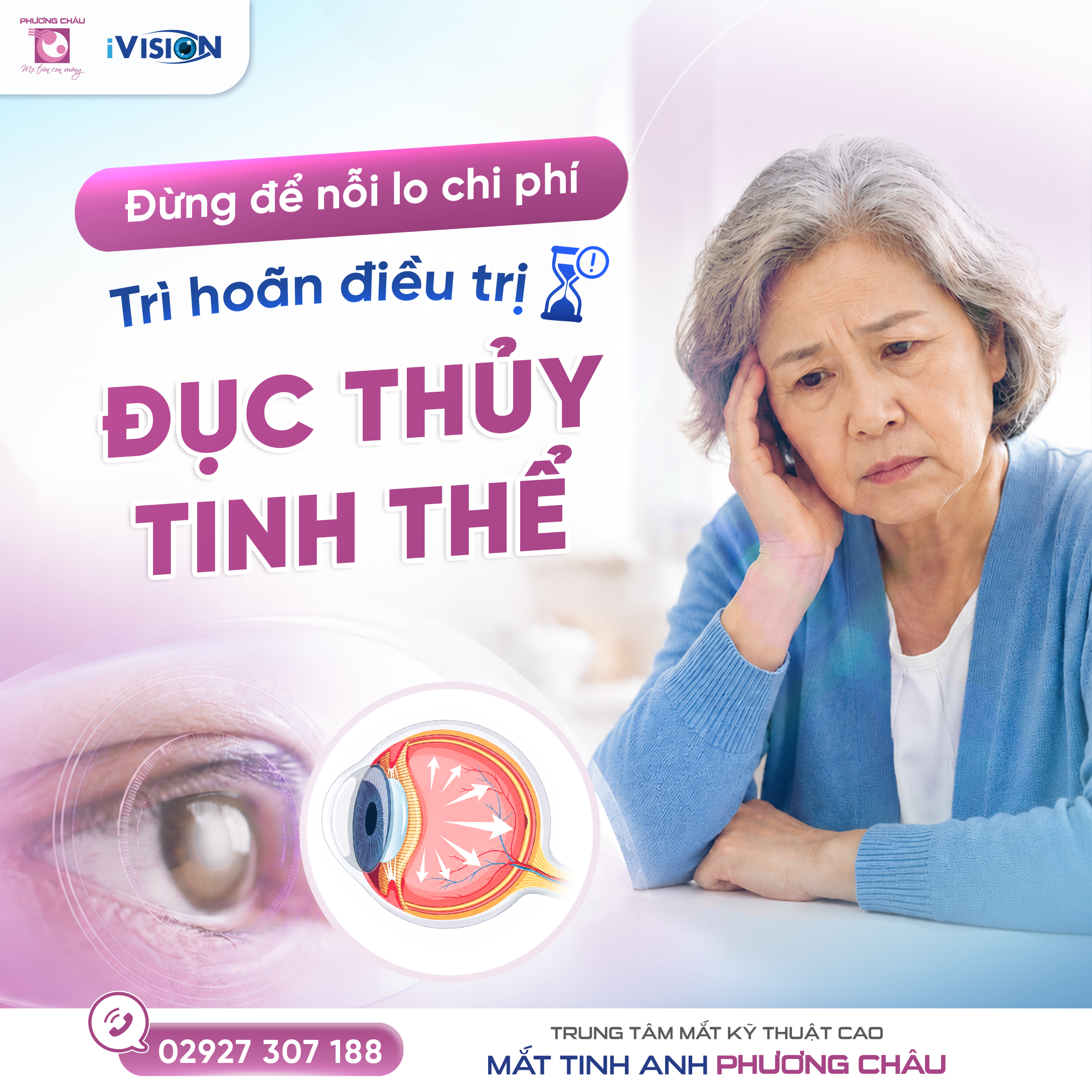 Mổ Phaco có BHYT tại Phương Châu: Chi phí chỉ từ 6 triệu đồng