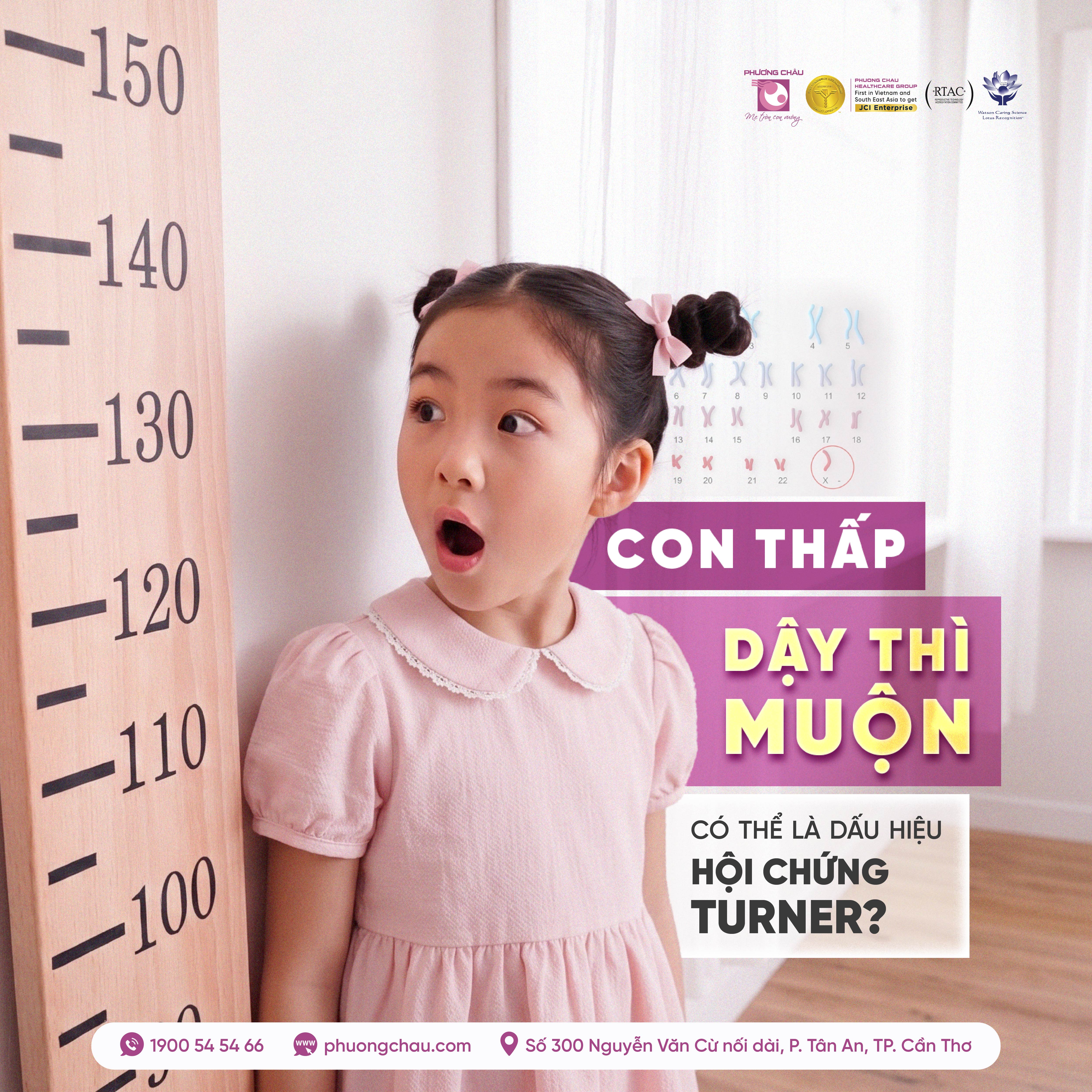 Hội chứng turner: Dấu hiệu nhận biết, chẩn đoán và điều trị