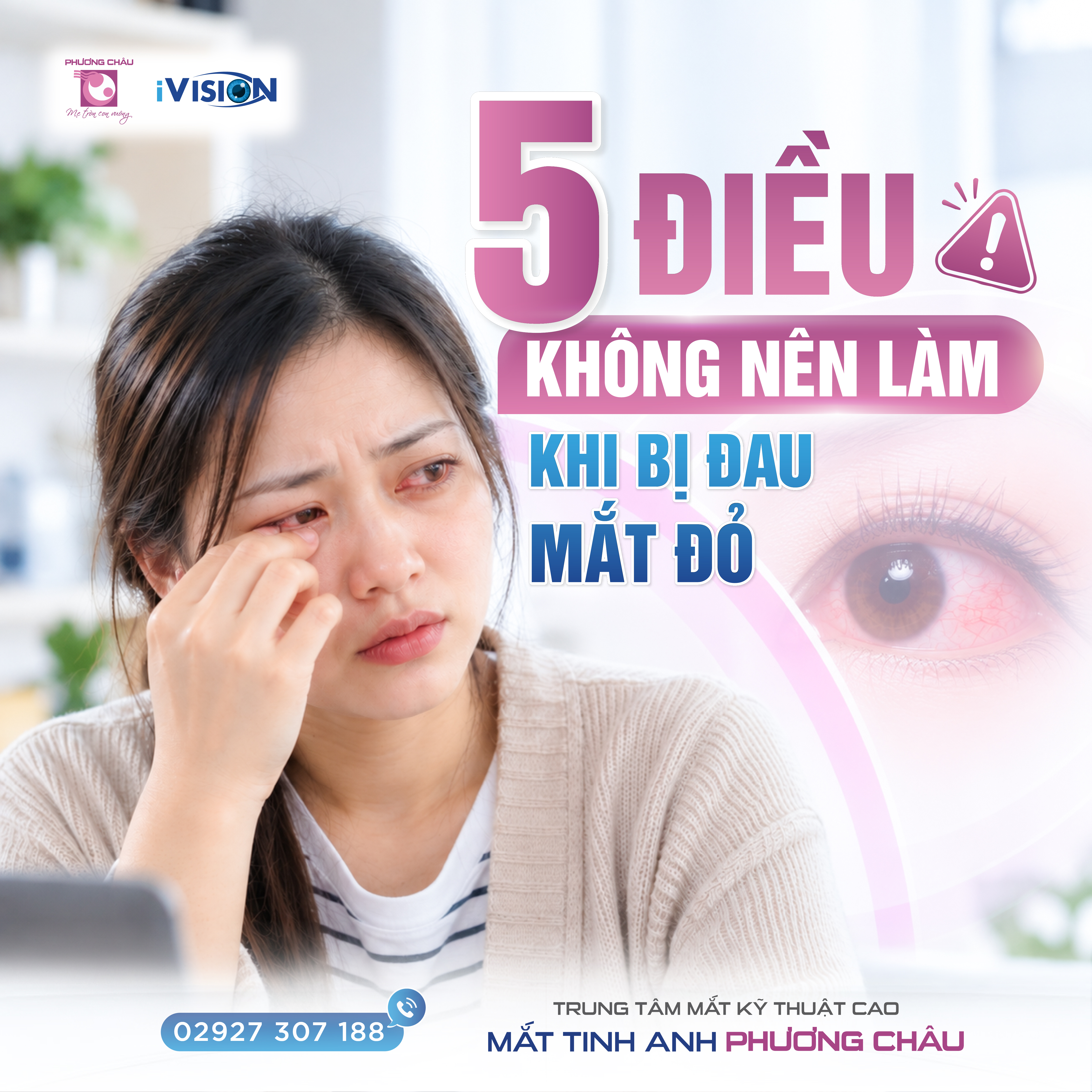 Đau mắt đỏ: 5 điều không nên làm để tránh bệnh nặng hơn và lây lan