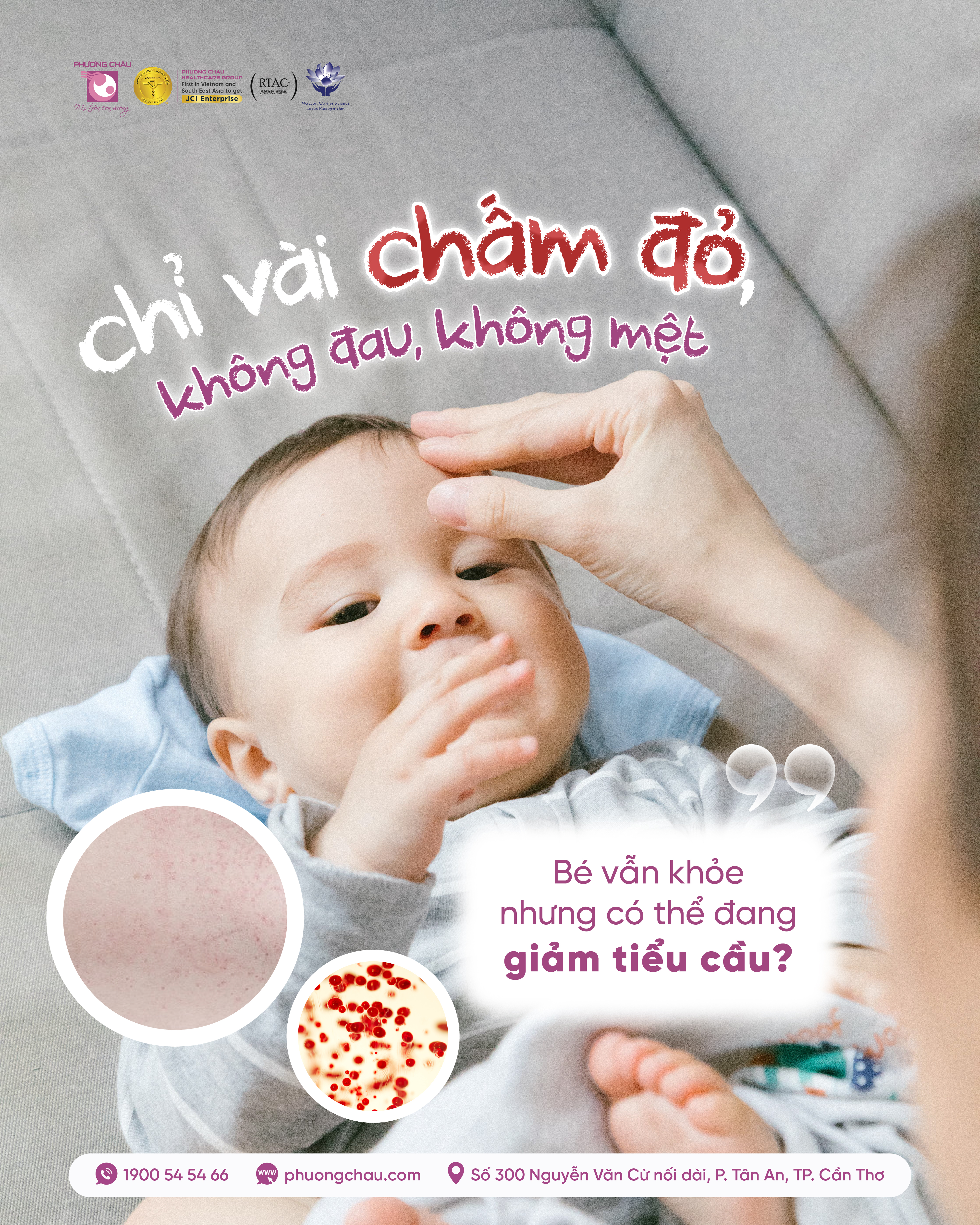 Giảm tiểu cầu miễn dịch ở trẻ: Dấu hiệu và khi nào cần đưa trẻ đi khám