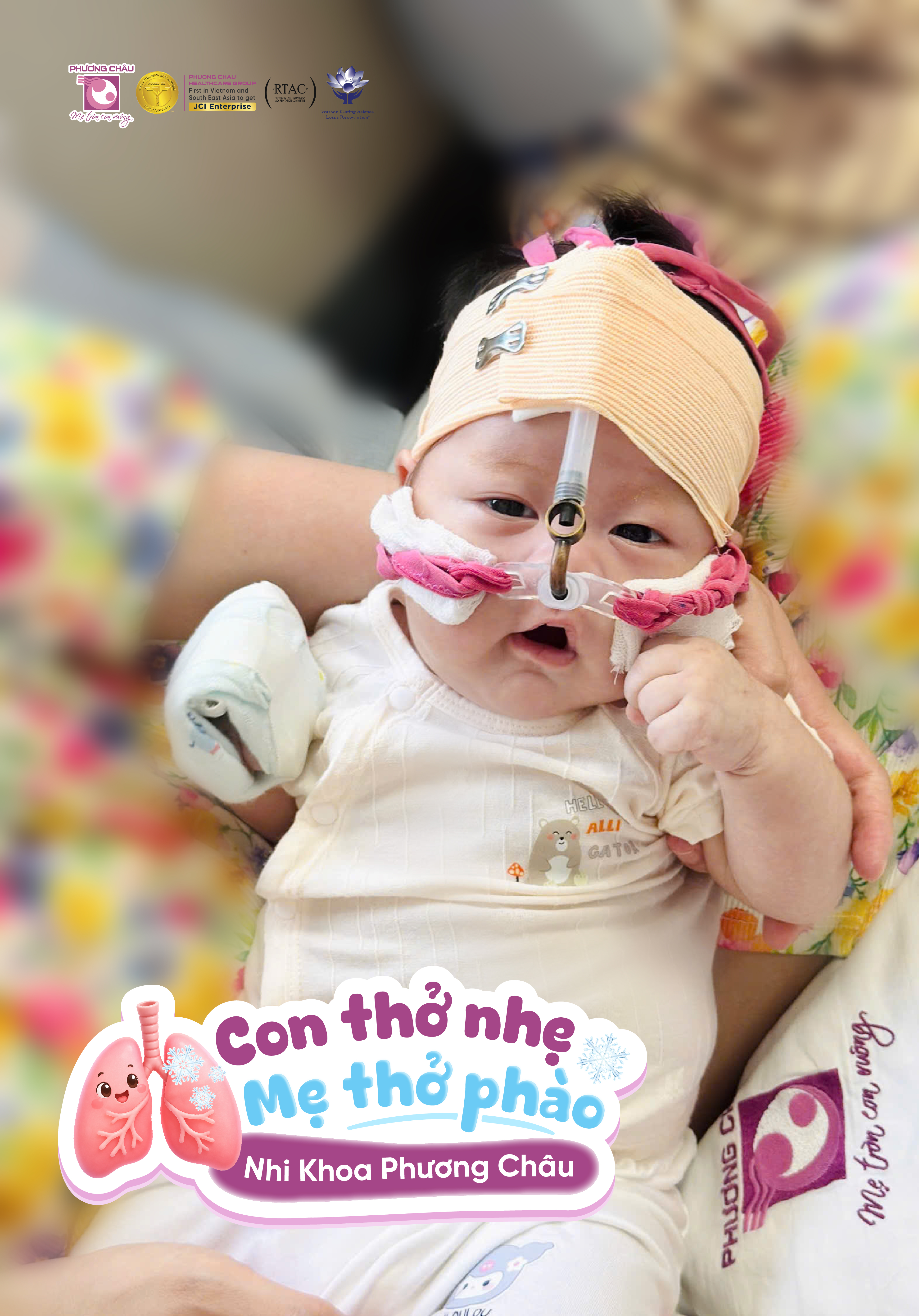 Ho, chảy mũi 3 ngày, bé trai 2 tháng tuổi diễn tiến nặng do RSV