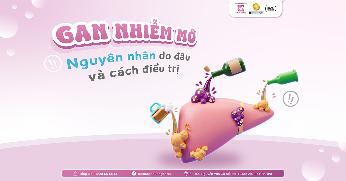 Gan nhiễm mỡ là bệnh lý rất phổ biến nhưng thường diễn tiến âm thầm nên dễ bị bỏ qua