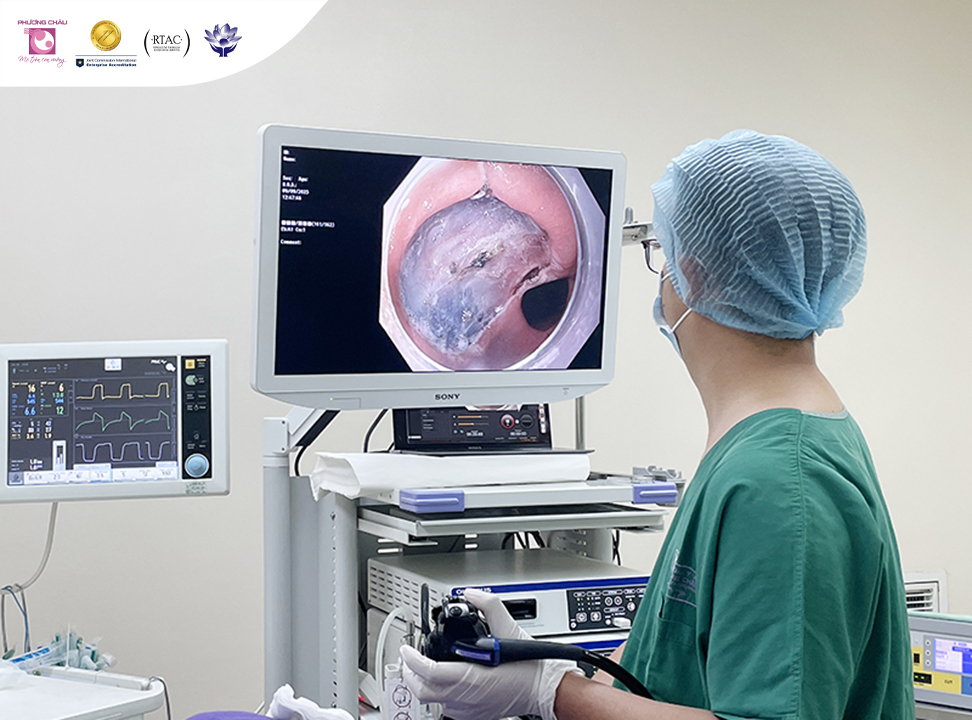 Bác sĩ Phương Châu đang thực hiện kỹ thuật cắt hớt dưới niêm mạc qua nội soi - ESD