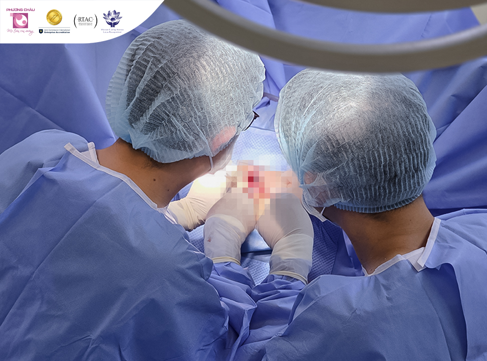 Nhiều người mắc bệnh trĩ nặng nhưng nhiều lần e dè chưa đi điều trị dứt điểm vì sợ đau sau phẫu thuật