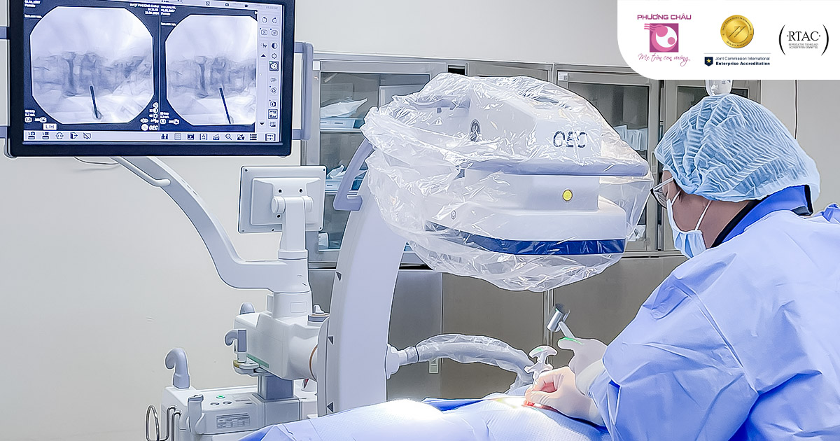 Toàn bộ quá trình bơm xi măng sinh học được thực hiện dưới sự hỗ trợ của màn tăng sáng C-arm