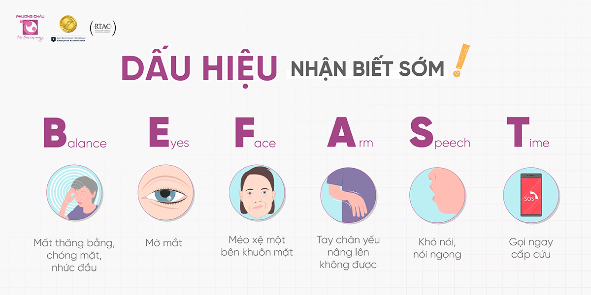 Dấu hiệu nhận biết sớm đột quỵ