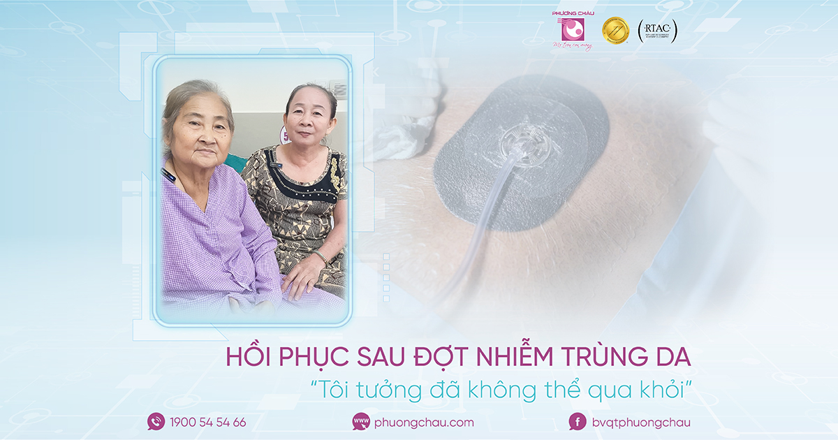 Hồi phục sau nhiễm trùng da nặng