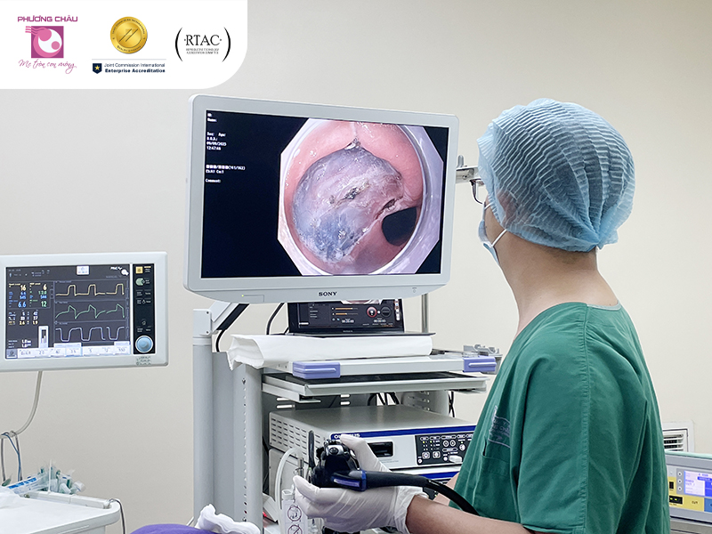 khâu diện cắt sau esd qua nội soi