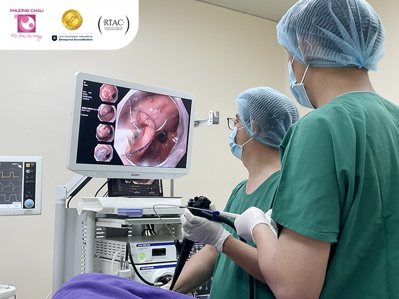 khâu diện cắt sau esd qua nội soi