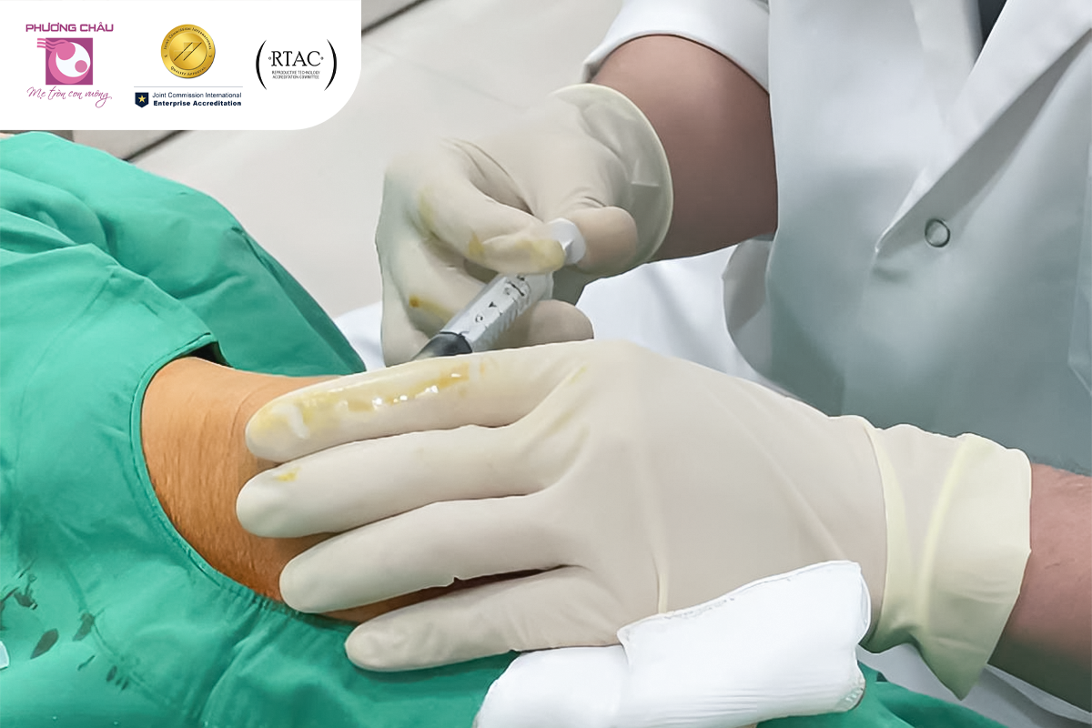 Hình ảnh tiêm huyết tương giàu tiểu cầu tại BVQT Phương Châu
