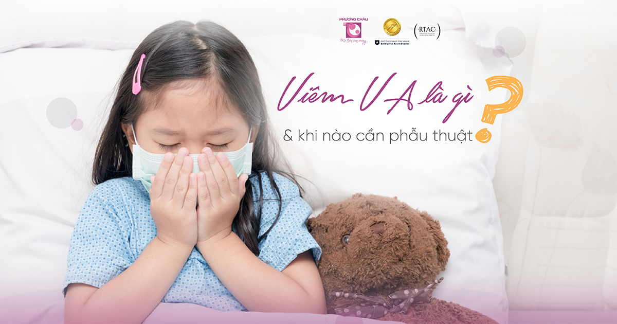 Viêm VA là tình trạng phổ biến ở trẻ nhỏ nhưng lại thường bị bỏ qua vì dễ nhầm lẫn với các bệnh hô hấp khác
