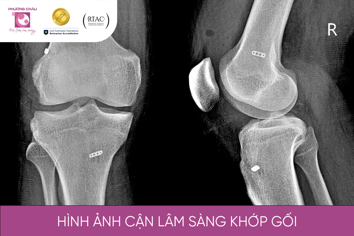 Hình ảnh cận lâm sàng