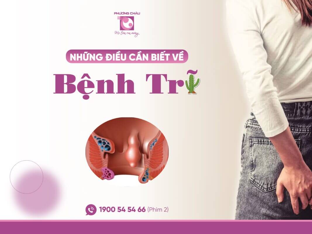 Những Điều Cần Biết Về Bệnh Trĩ