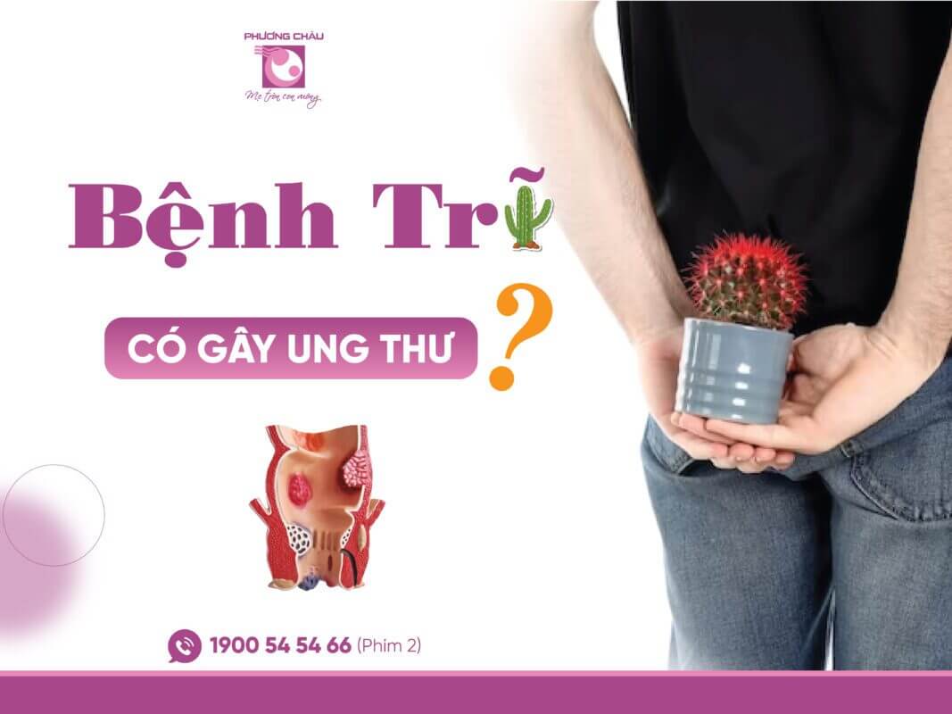 Bệnh Trĩ Có Gây Ung Thư?