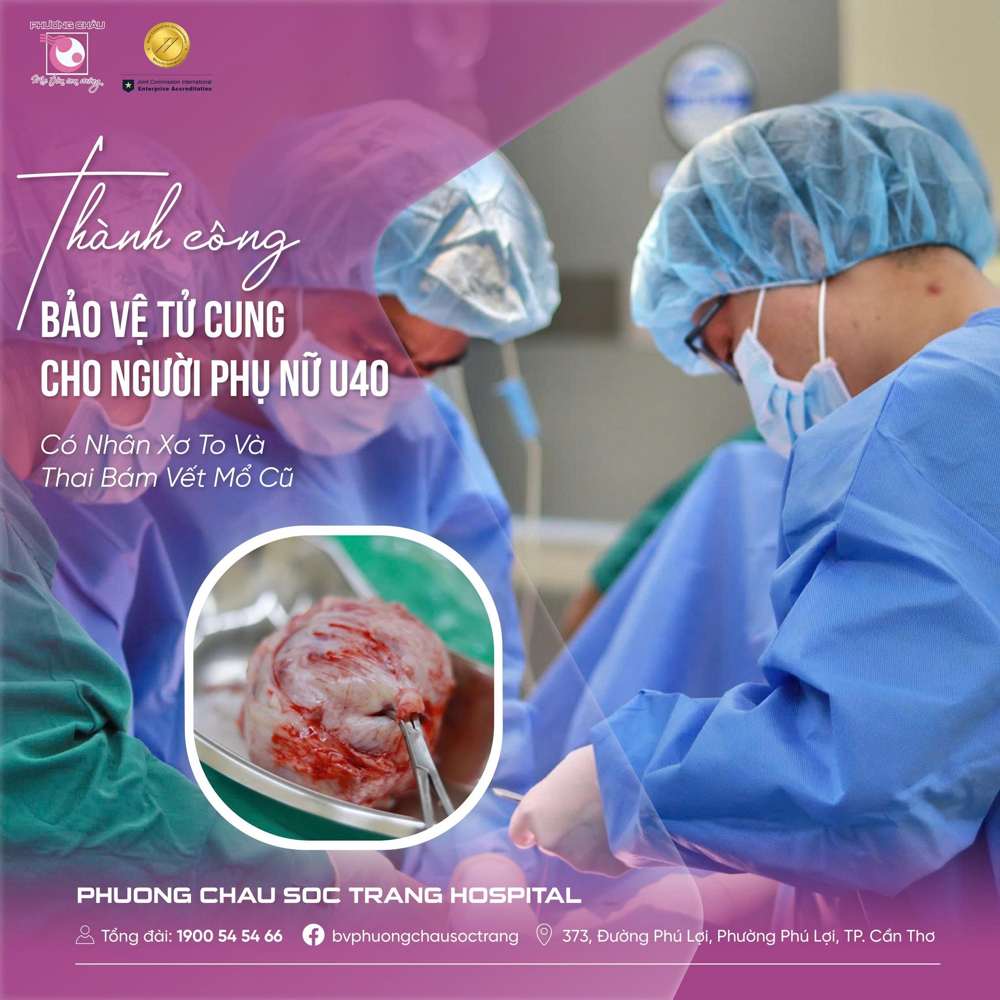 THÀNH CÔNG BẢO VỆ TỬ CUNG NGƯỜI PHỤ NỮ U40