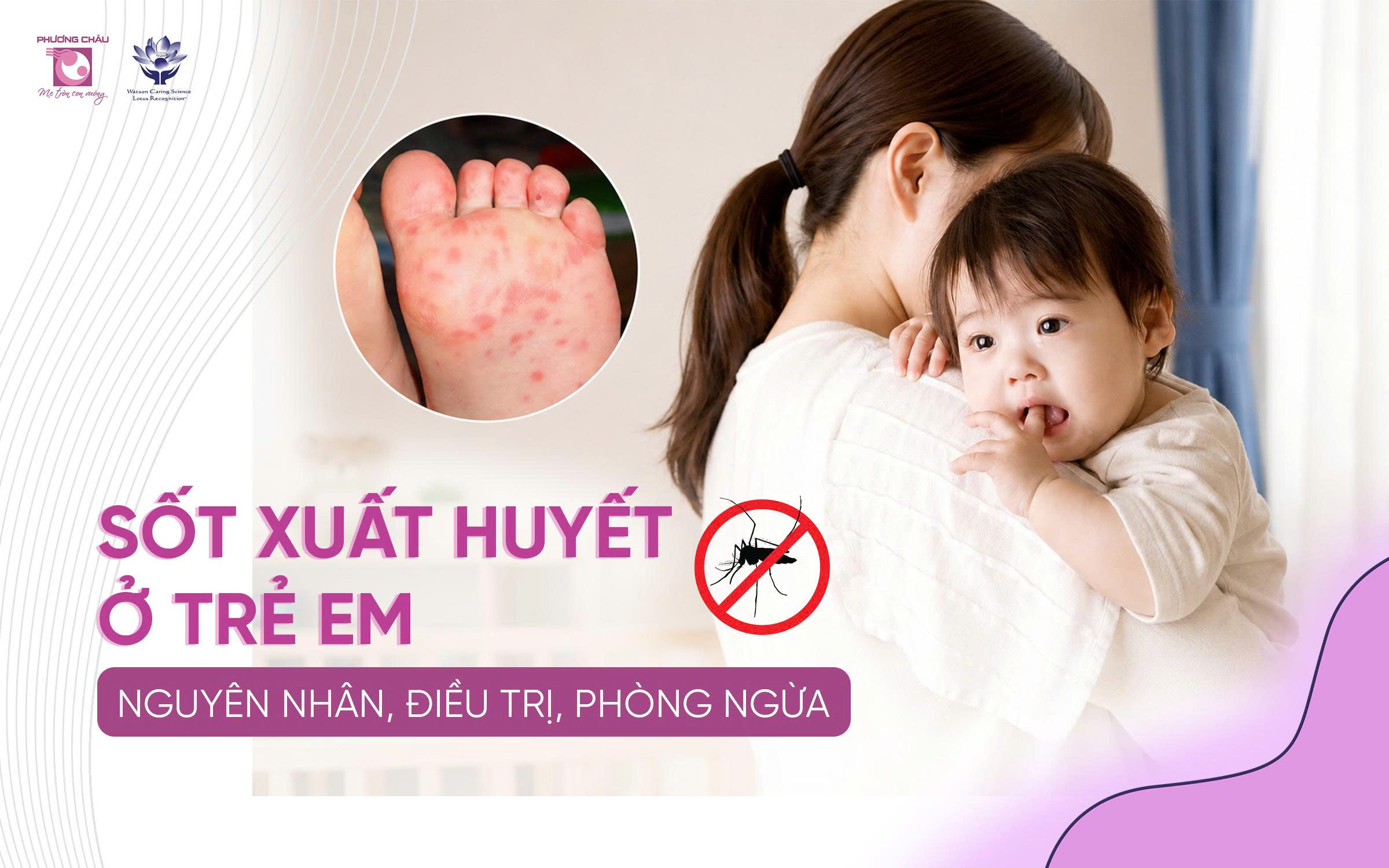 Giao Mùa Cũng Là Thời Điểm Sốt Xuất Huyết Gia Tăng