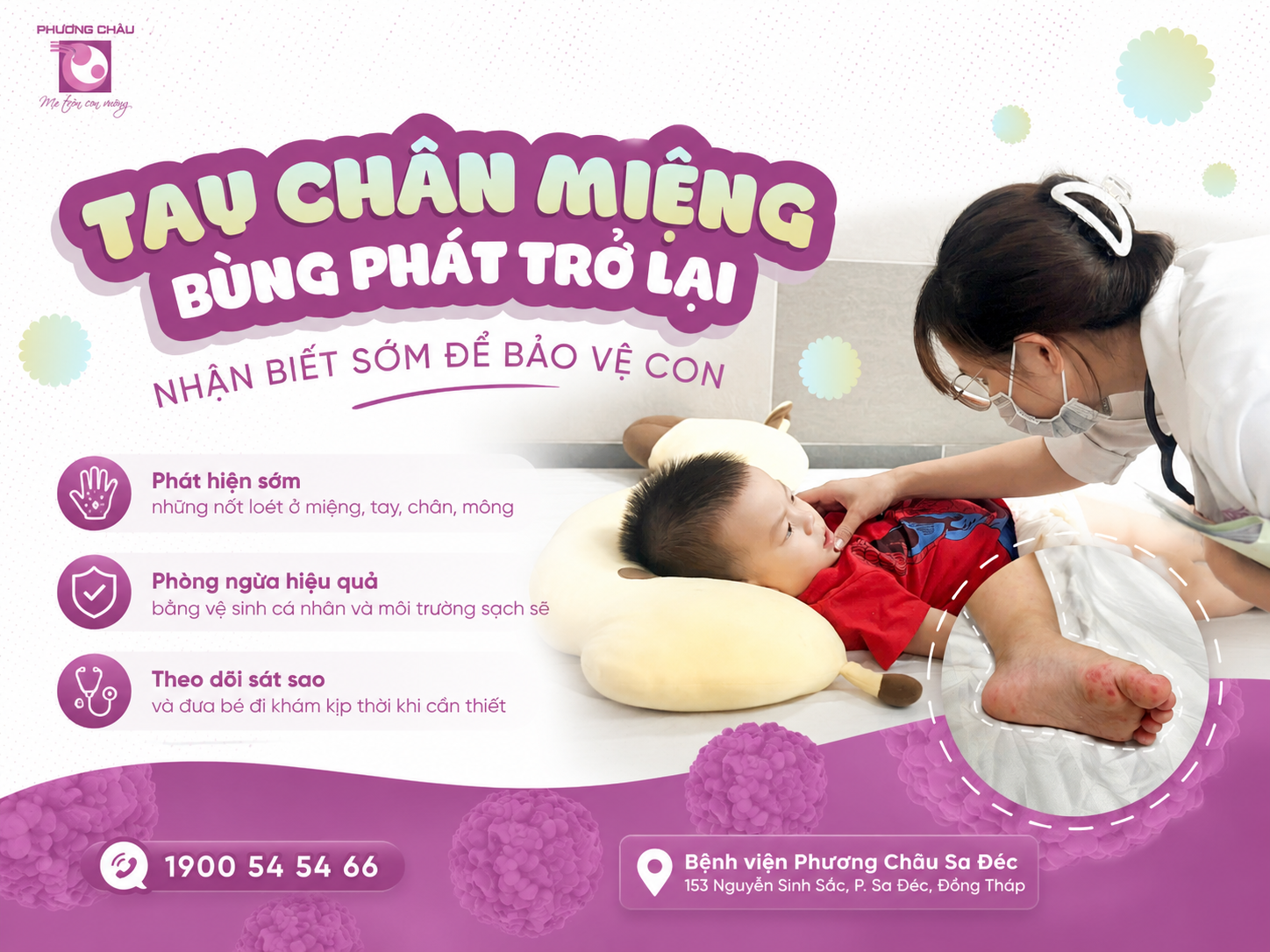 TAY CHÂN MIỆNG BÙNG PHÁT TRỞ LẠI - BA MẸ CHÚ Ý ĐỂ BẢO VỆ CON