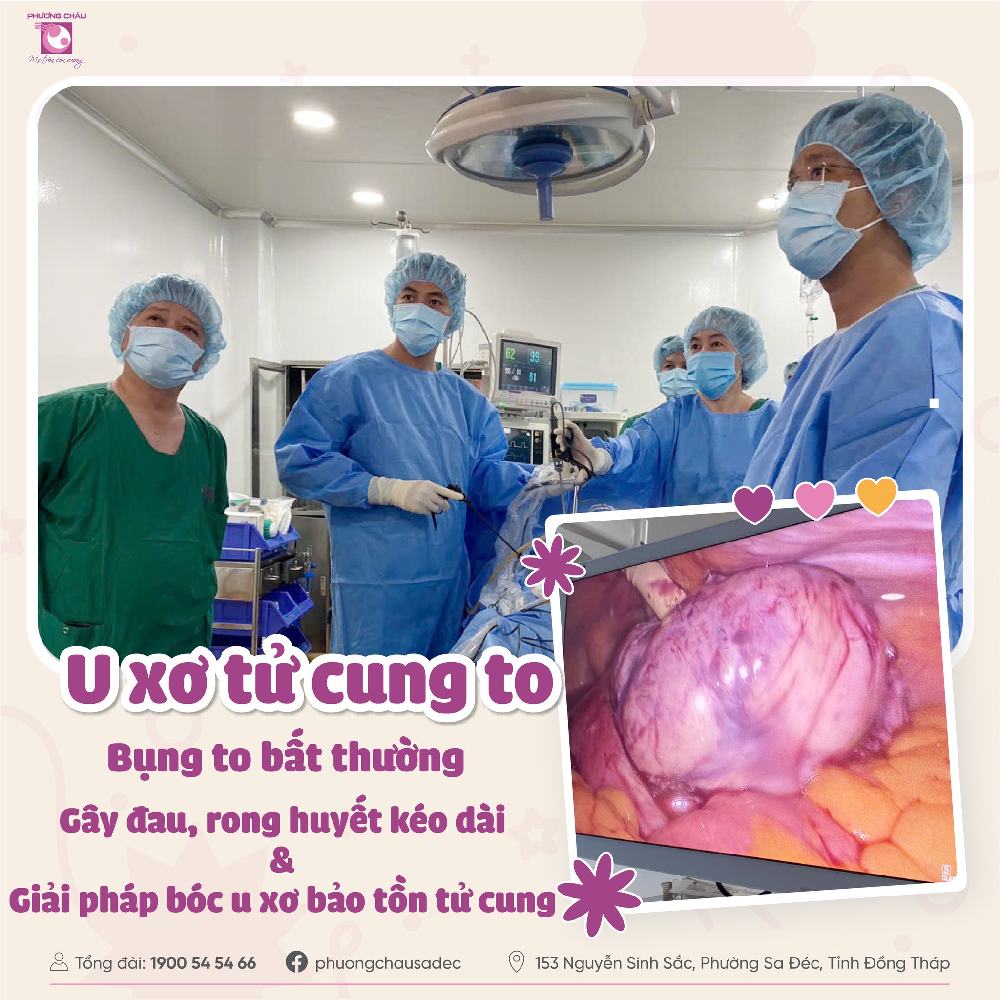 U XƠ TỬ CUNG TO – KHI BỤNG DƯỚI TO NHANH, ĐAU KÉO DÀI VÀ RONG HUYẾT, GIẢI PHÁP BÓC U XƠ BẢO TỒN TỬ CUNG