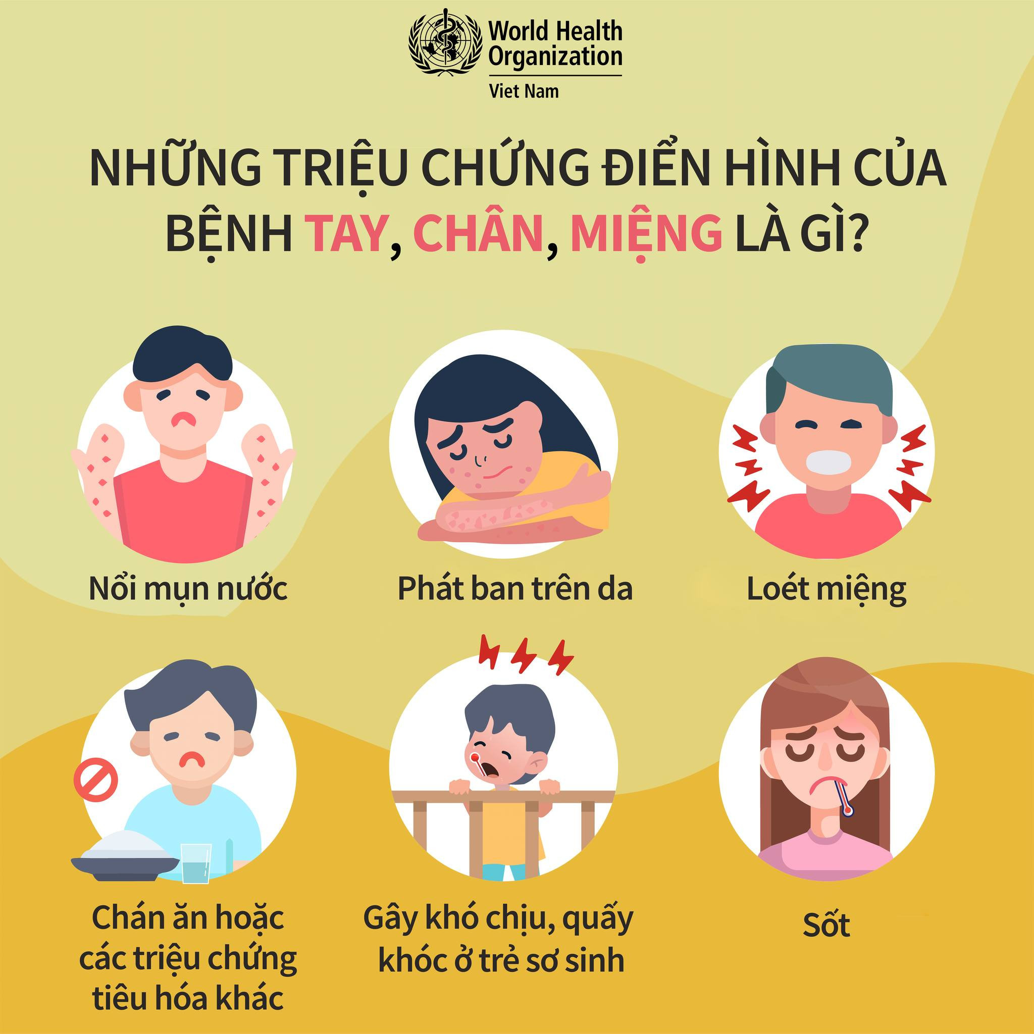 Cảnh báo bệnh Tay Chân Miệng tại Đồng Tháp – Phụ huynh cần chú ý!