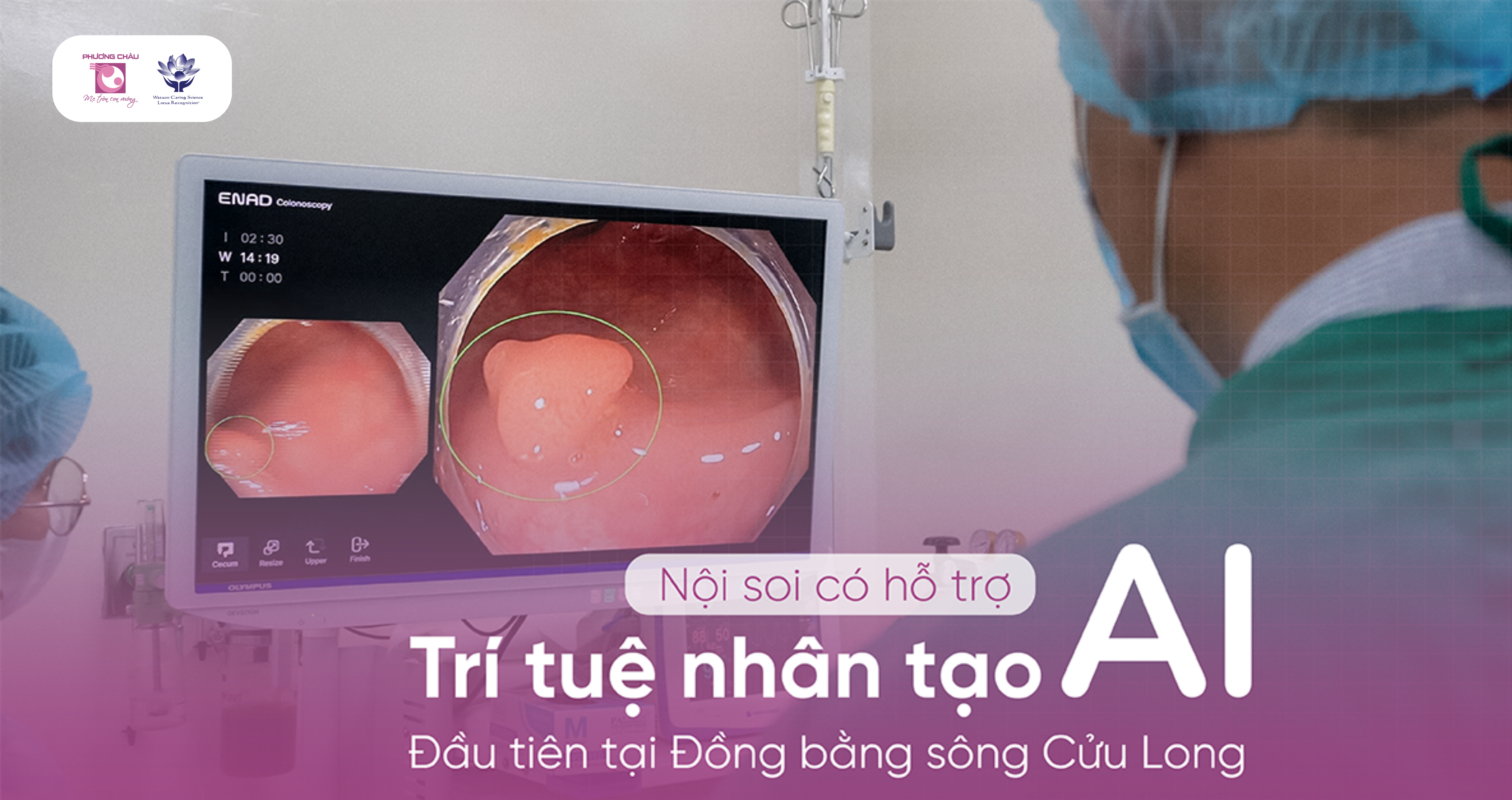 Nội Soi Tiêu Hóa Có Hỗ Trợ AI: Phát hiện sớm ung thư tiêu hóa