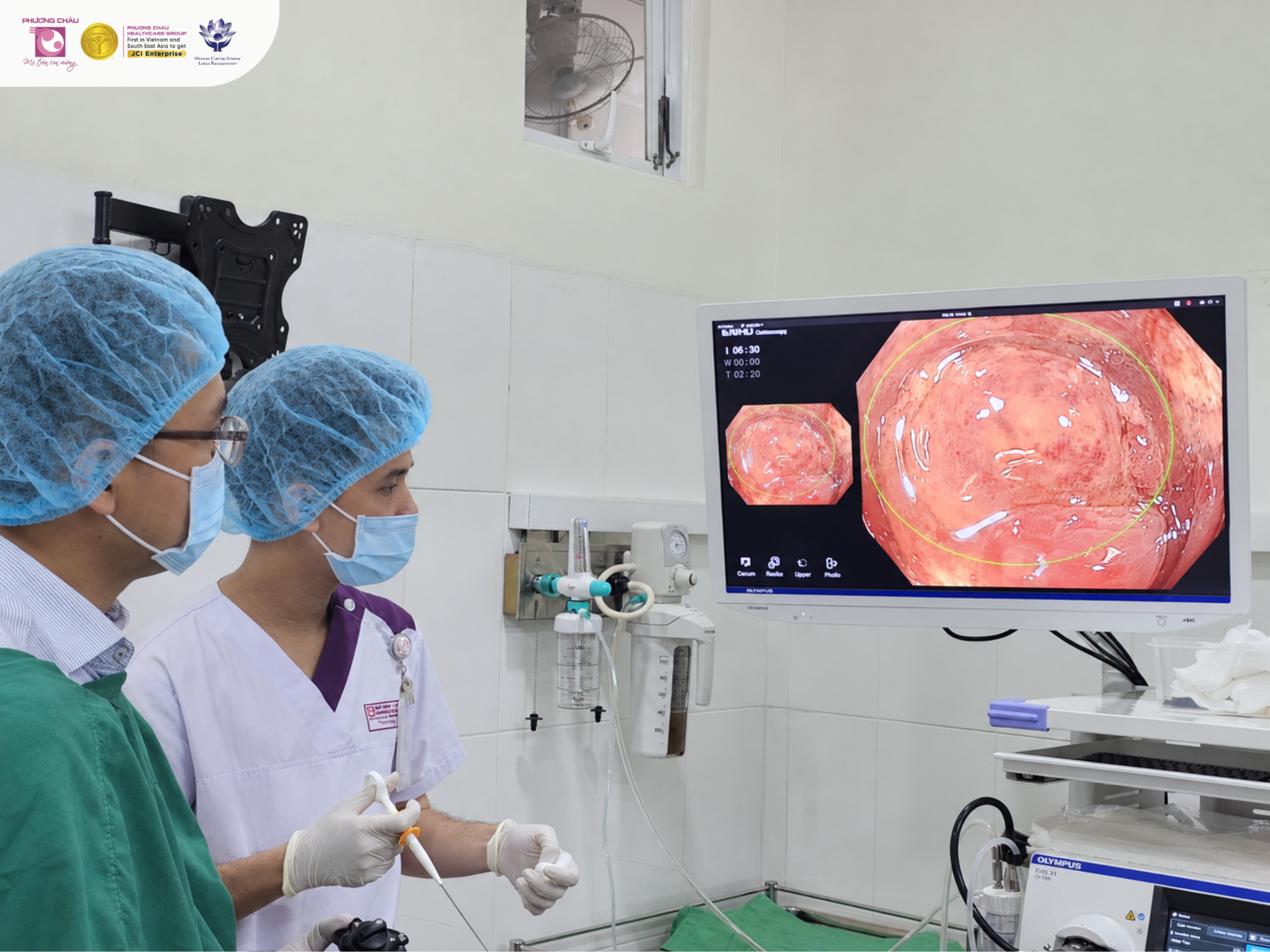 TIÊU PHÂN MÁU SUỐT 2 TUẦN: NỘI SOI PHÁT HIỆN TỔN THƯƠNG NGHIÊM TRỌNG